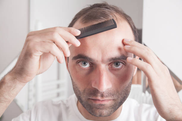 How Much Is Hair Transplant in Istanbul Medical Tourism?
